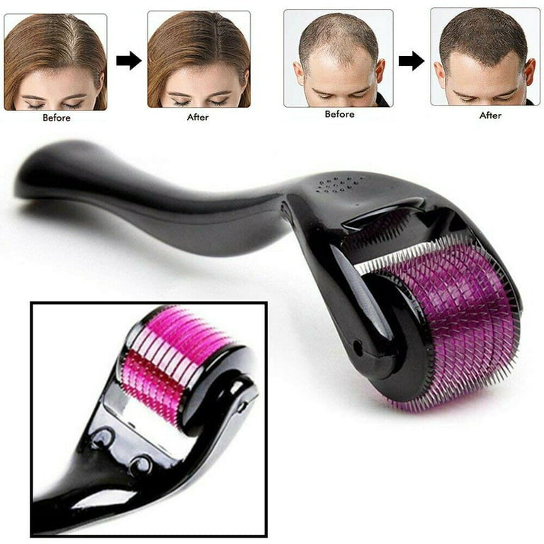 Derma Roller 0.5 mm Micro-Needle for Skin Care, Hair Growth, Acne Scars & Anti-Ageing